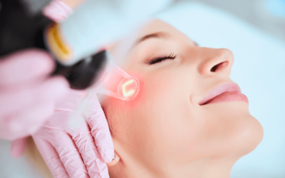 Reducering af rynker og fine linjer med CO2-laser: